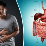 6 Unexpected Causes of Constipation (And How to Fix Them)
