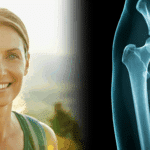 Strengthen Your Bones: 3 Proactive Steps for Fracture Prevention
